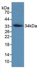 COL7A1 Antibody in Western Blot (WB)