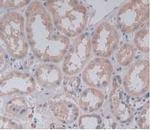 PLA2G4A Monoclonal Antibody (C19)