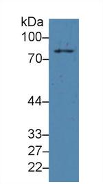 PLA2G4A Antibody in Western Blot (WB)
