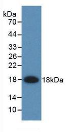 FABP2 Monoclonal Antibody (C1)