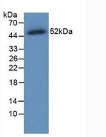 Ferroportin Monoclonal Antibody (C7)