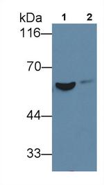 Fibrinogen Beta Chain Antibody in Western Blot (WB)
