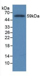 Fibrinogen Beta Chain Antibody in Western Blot (WB)