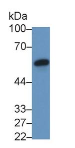 Fibrinogen Beta Chain Antibody in Western Blot (WB)