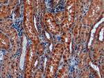 alpha Galactosidase Monoclonal Antibody (C8)