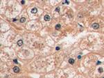 GLUT1 Antibody in Immunohistochemistry (Paraffin) (IHC (P))