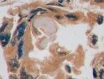 GLUT1 Antibody in Immunohistochemistry (Paraffin) (IHC (P))