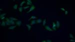 HSPA1L Monoclonal Antibody (2-1#)