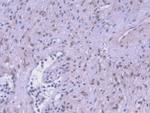 HSPA1A Antibody in Immunohistochemistry (Paraffin) (IHC (P))