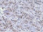 HSPA1A Antibody in Immunohistochemistry (Paraffin) (IHC (P))