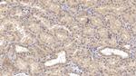 SHH Antibody in Immunohistochemistry (Paraffin) (IHC (P))