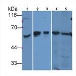 SHH Antibody in Western Blot (WB)