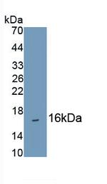 Hemoglobin alpha-1 Antibody in Western Blot (WB)
