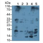 IGF1 Antibody in Western Blot (WB)