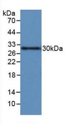 IGFBP-1 Antibody in Western Blot (WB)