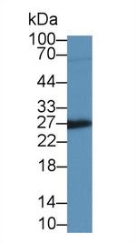 IGFBP4 Monoclonal Antibody (A3)