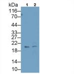 IGFBP4 Monoclonal Antibody (C15)