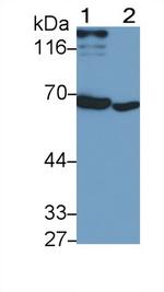 IFNAR1 Monoclonal Antibody (C7)