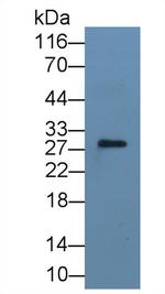 IL-1 alpha Monoclonal Antibody (3#)