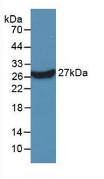 KPNA2 Antibody in Western Blot (WB)