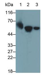 Cytokeratin 6A Monoclonal Antibody (C2)
