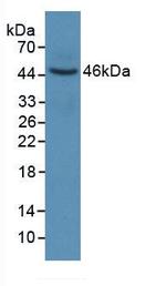 Cytokeratin 6A Antibody in Western Blot (WB)