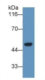 LCAT Antibody in Western Blot (WB)
