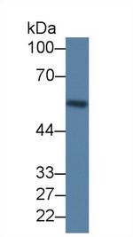 LRG1 Monoclonal Antibody (D2)
