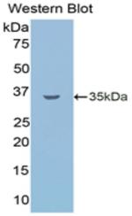 LSR Antibody in Western Blot (WB)