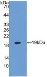 LPCAT3 Antibody in Western Blot (WB)