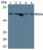 LPCAT3 Monoclonal Antibody (6-2#)