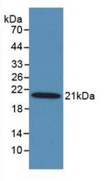 MASP2 Antibody in Western Blot (WB)