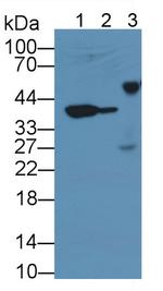 MMP13 Monoclonal Antibody (C2)