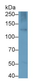 Nephrin Antibody in Western Blot (WB)