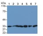 NGF Monoclonal Antibody (C2)