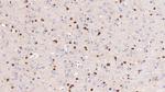 NGAL Antibody in Immunohistochemistry (Paraffin) (IHC (P))