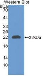 NGAL Antibody in Western Blot (WB)