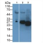 NGAL Monoclonal Antibody (E1)
