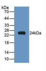 NGAL Antibody in Western Blot (WB)