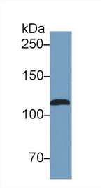 iNOS Antibody in Western Blot (WB)