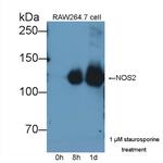 iNOS Antibody in Western Blot (WB)
