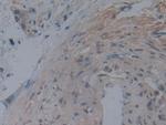 Noggin Monoclonal Antibody (A7)