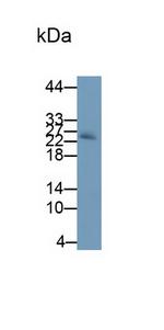 Noggin Antibody in Western Blot (WB)