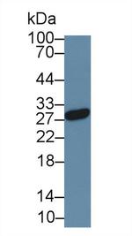 Noggin Antibody in Western Blot (WB)