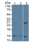 PTHLH Antibody in Western Blot (WB)