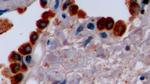 SFTPA1 Antibody in Immunohistochemistry (Paraffin) (IHC (P))