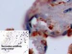 SFTPA1 Antibody in Immunohistochemistry (Paraffin) (IHC (P))