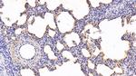 SFTPA1 Antibody in Immunohistochemistry (Paraffin) (IHC (P))
