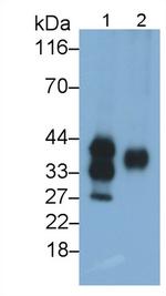 SFTPA1 Antibody in Western Blot (WB)
