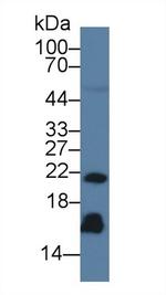 REG3G Antibody in Western Blot (WB)